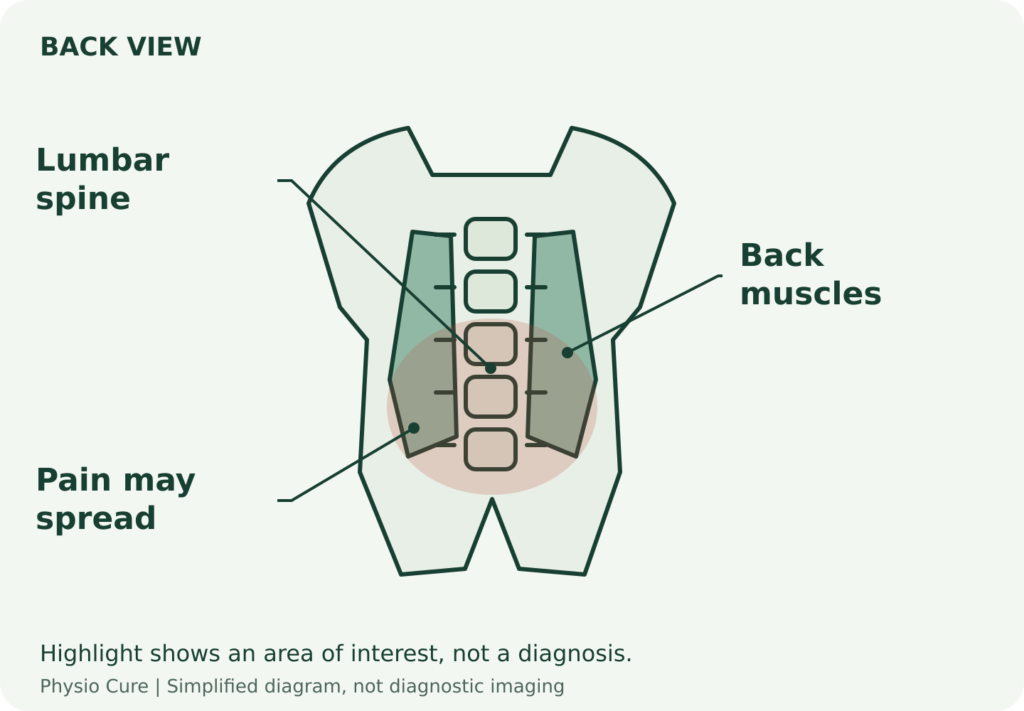 Back-view schematic highlighting the lumbar region and surrounding muscles without implying a single damaged structure.