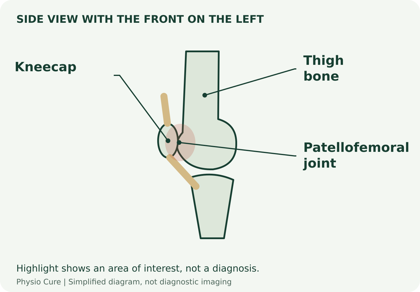 Side-view knee showing the patella at the front of the femur and the patellofemoral joint highlighted.