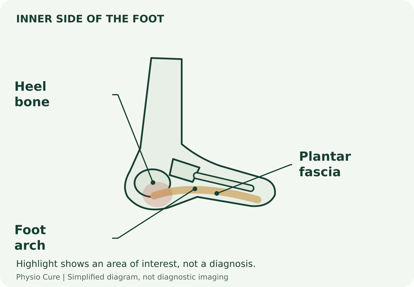 Simplified inner-foot diagram showing the plantar fascia extending from the heel towards the forefoot.