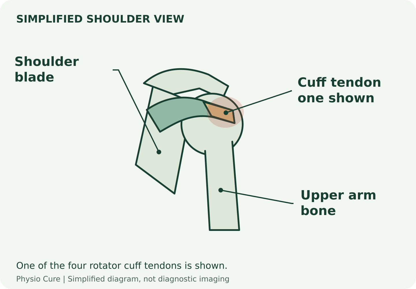 Simplified shoulder diagram illustrating a rotator cuff tendon.